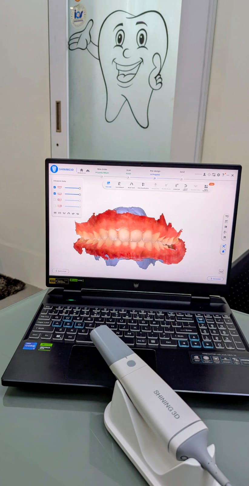 Shining 3D digital intraoral scanner in use at the clinic